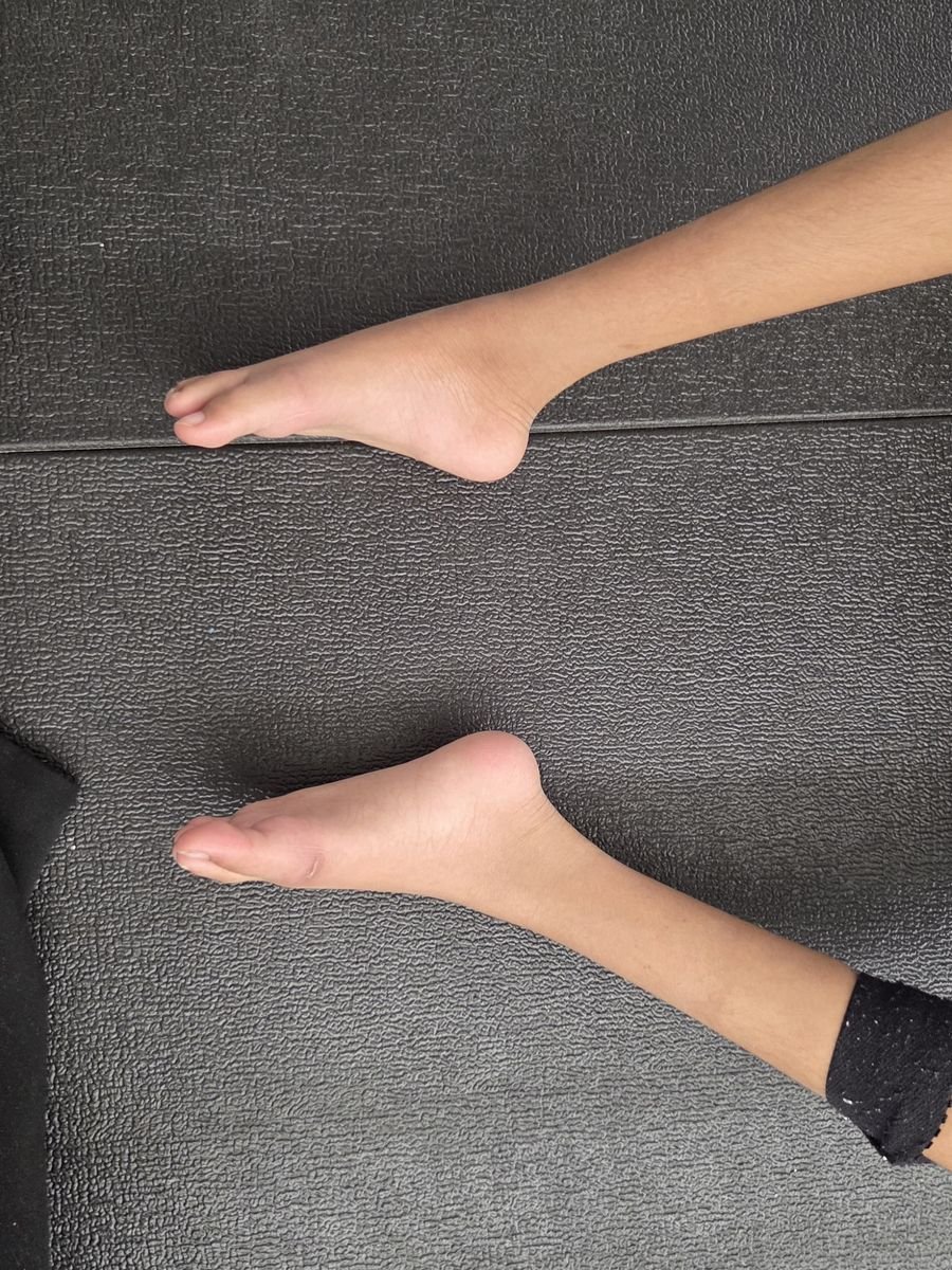 After treatment at Kairos Physio