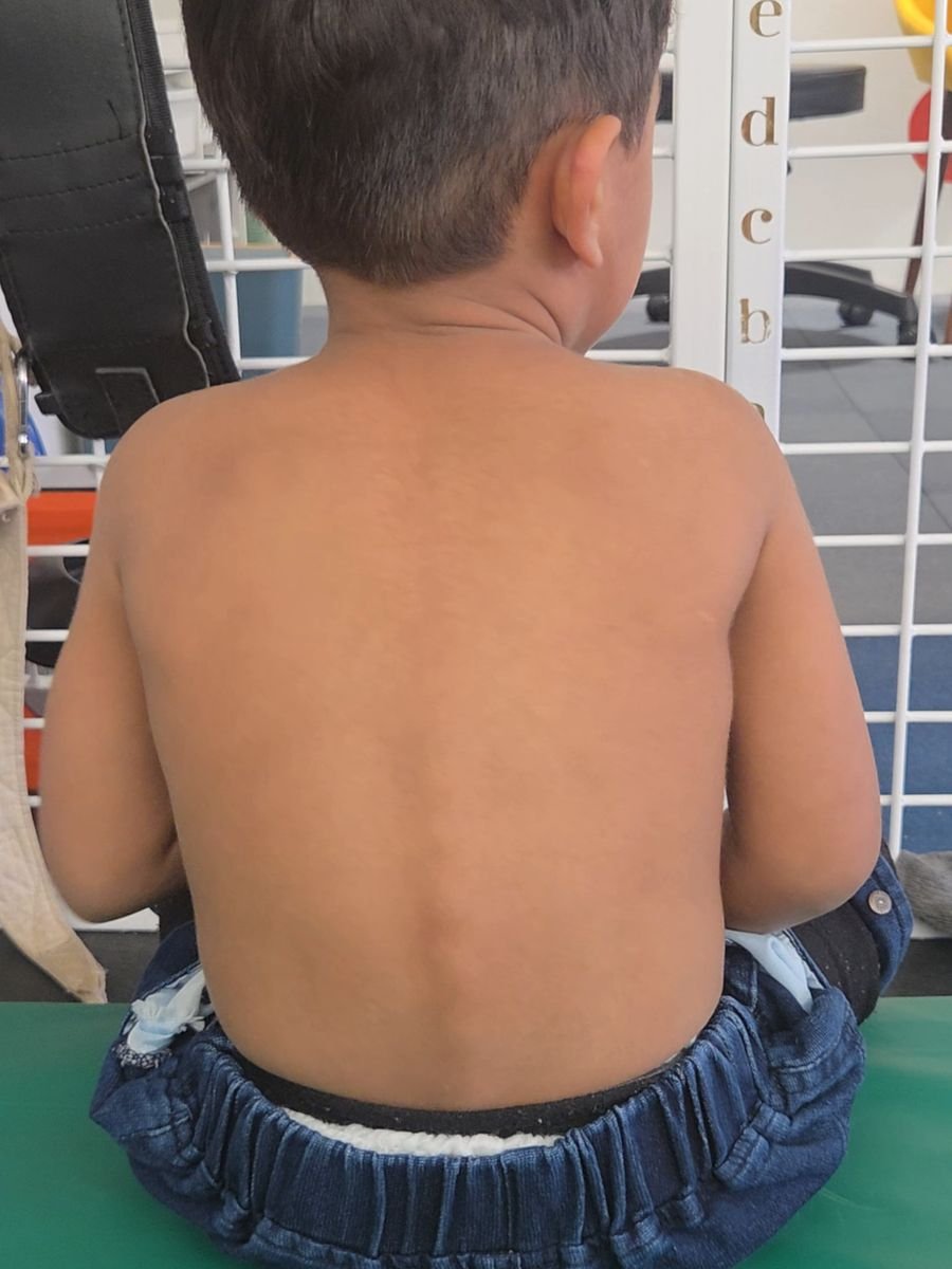 After treatment at Kairos Physio